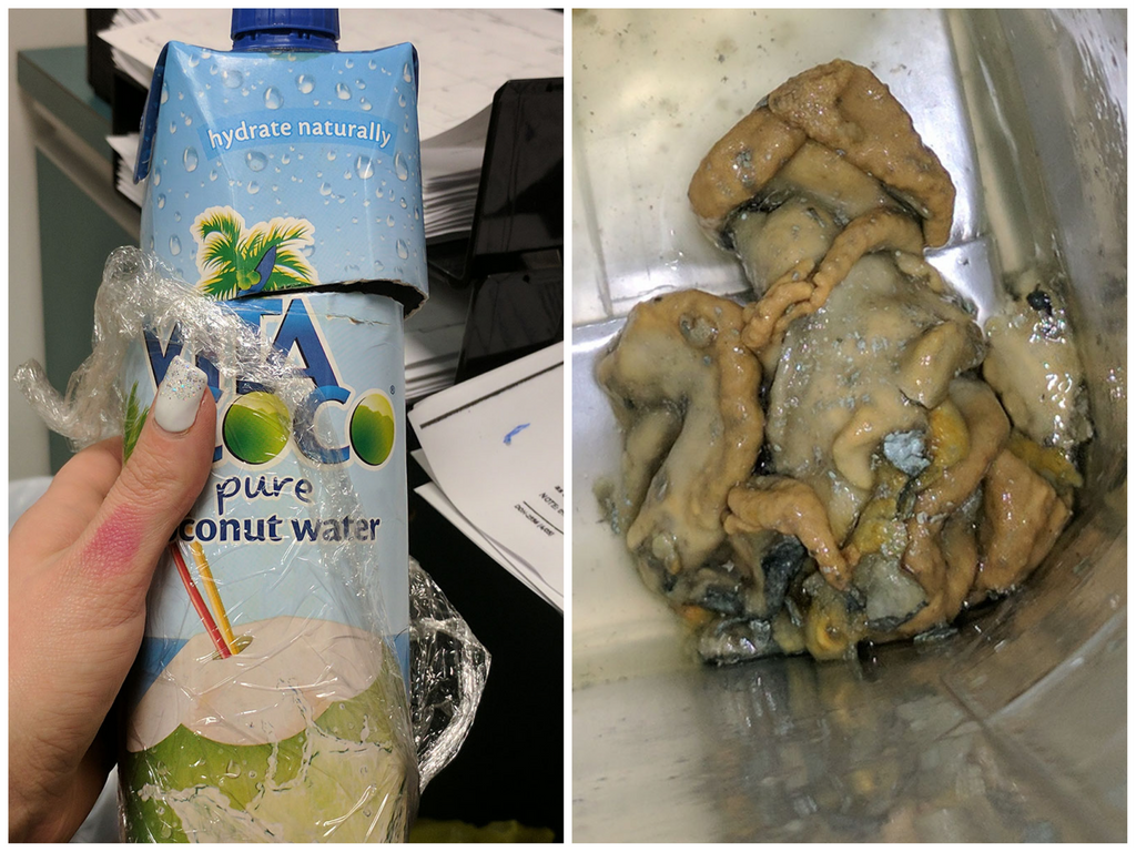 WOMAN SAYS SQUID-LIKE SUBSTANCE WAS FLOATING IN BOTTLE OF COCONUT WATER